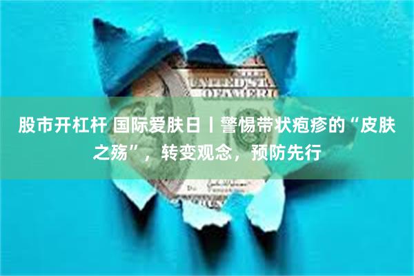 股市开杠杆 国际爱肤日丨警惕带状疱疹的“皮肤之殇”，转变观念，预防先行